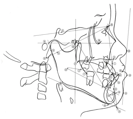 Manual Illustration